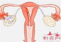 成都试管代孕术前检查流程_成都双卵双胎如何看龙凤胎_成都供卵助孕要多少钱